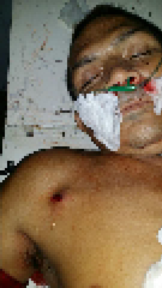 Senador_tenta_homicio_05_02_edited